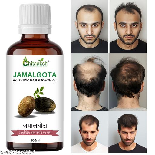 Jamalghota Hair Growth Oil – Pack of 2 (30ml each)